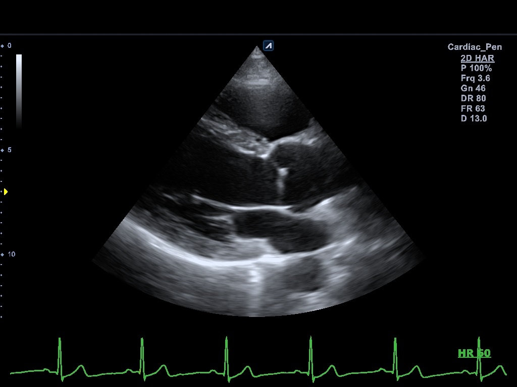 اجهزة سونار و ايكو Ultrasound & Echo جهاز سونار Alpinion E-CUBE 8 LE