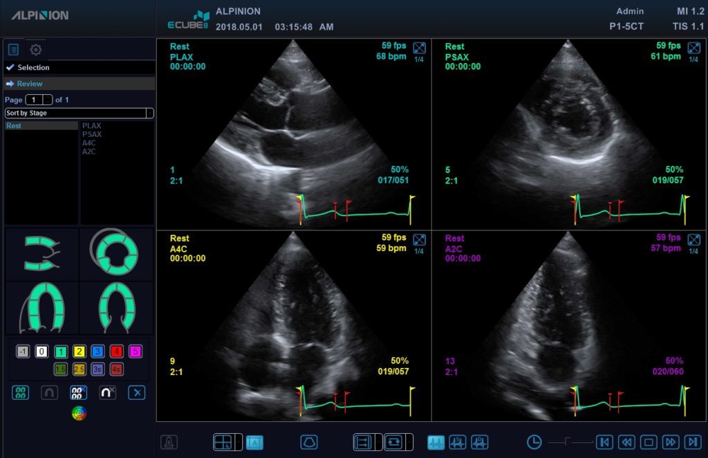 اجهزة سونار و ايكو Ultrasound & Echo جهاز سونار Alpinion E-CUBE 8 LE