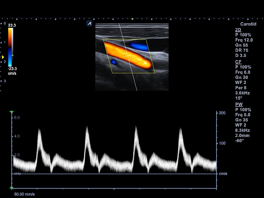 اجهزة سونار و ايكو Ultrasound & Echo جهاز سونار Alpinion E-CUBE 8 LE