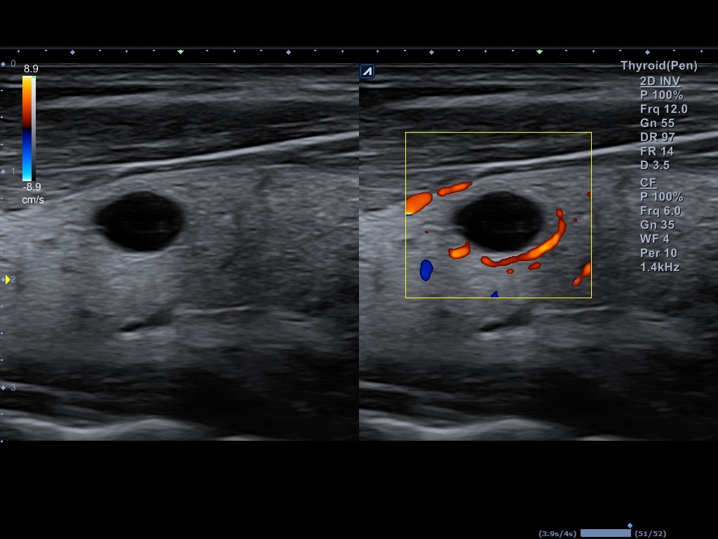 اجهزة سونار و ايكو Ultrasound & Echo جهاز سونار Alpinion E-CUBE 8 LE