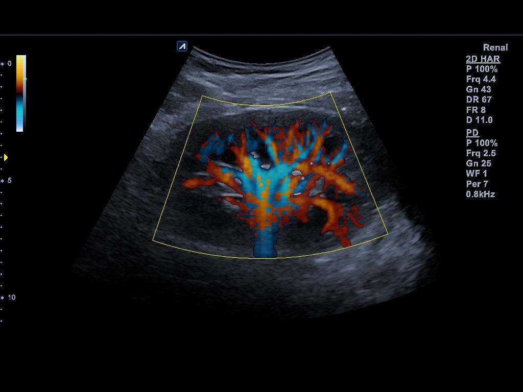 اجهزة سونار و ايكو Ultrasound & Echo جهاز سونار Alpinion E-CUBE 8 LE