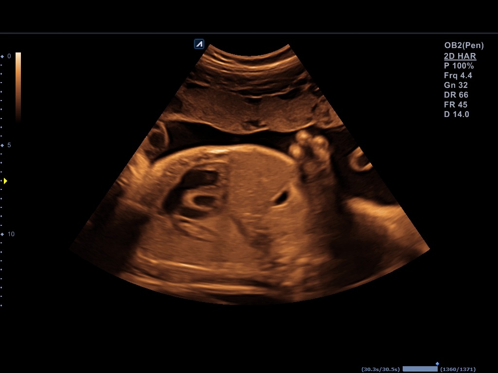 اجهزة سونار و ايكو Ultrasound & Echo جهاز سونار Alpinion E-CUBE 8 LE