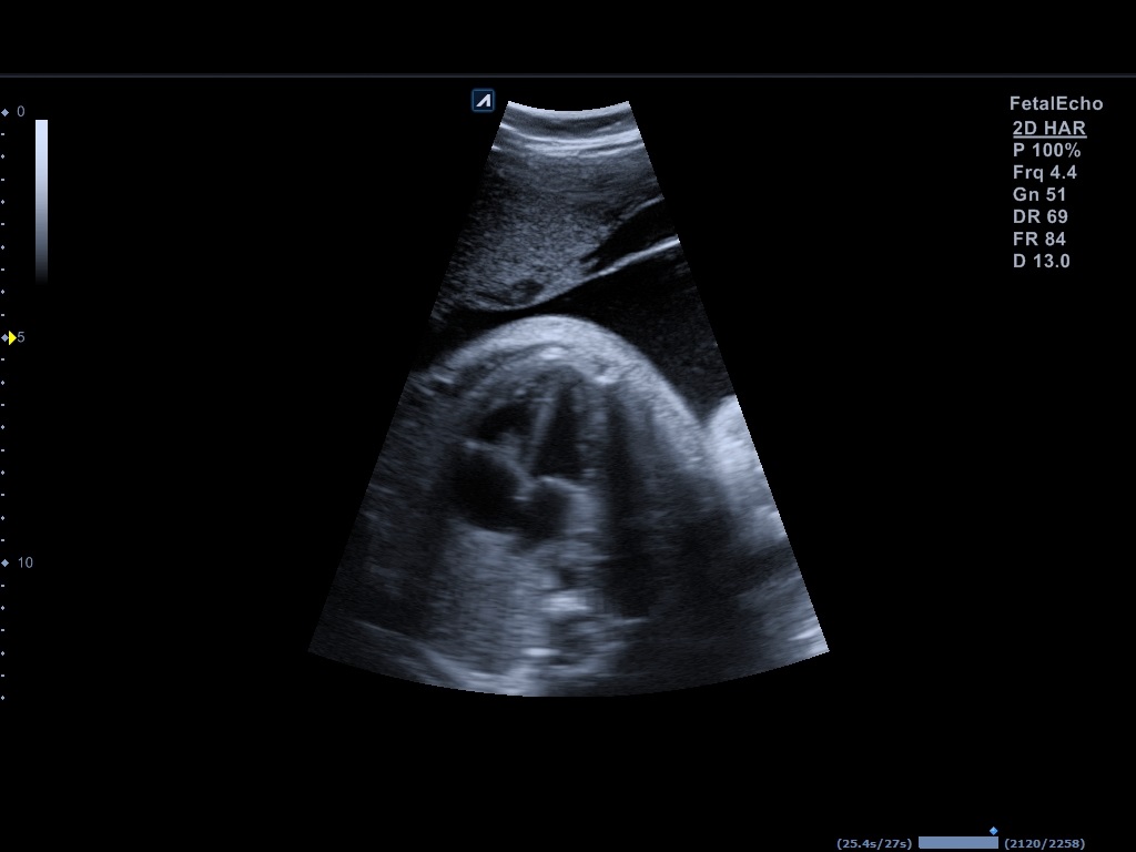 اجهزة سونار و ايكو Ultrasound & Echo جهاز سونار Alpinion E-CUBE 8 LE