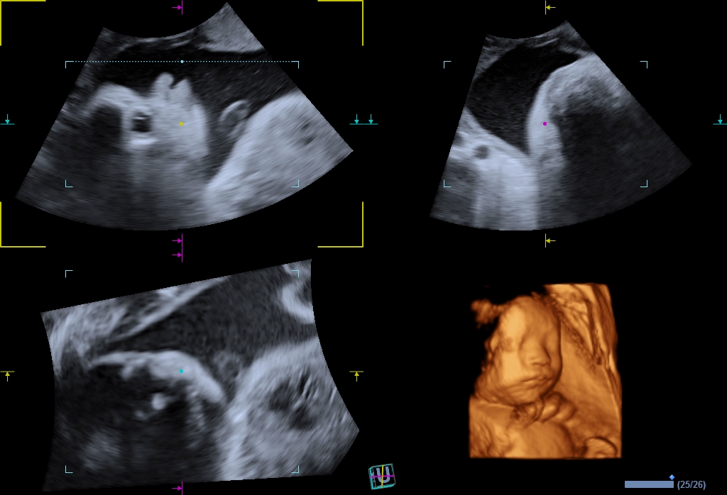 اجهزة سونار و ايكو Ultrasound & Echo جهاز سونار Alpinion E-CUBE 8 LE