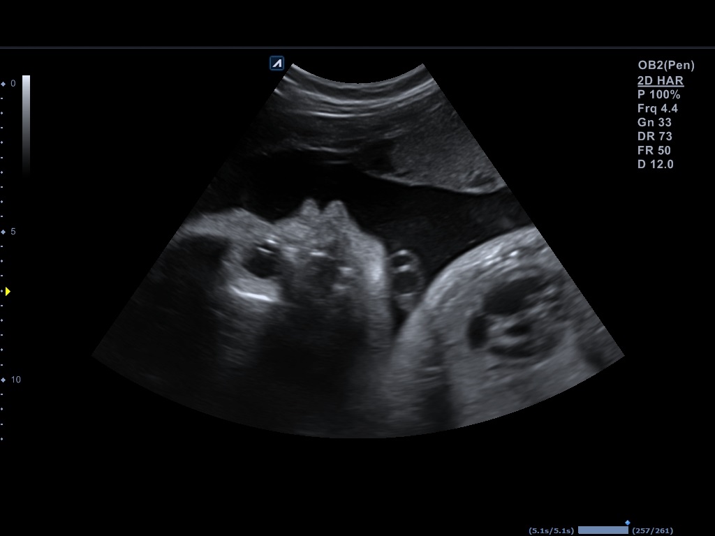 اجهزة سونار و ايكو Ultrasound & Echo جهاز سونار Alpinion E-CUBE 8 LE