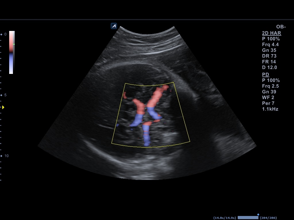 اجهزة سونار و ايكو Ultrasound & Echo جهاز سونار Alpinion E-CUBE 8 LE