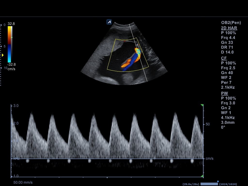 اجهزة سونار و ايكو Ultrasound & Echo جهاز سونار Alpinion E-CUBE 8 LE