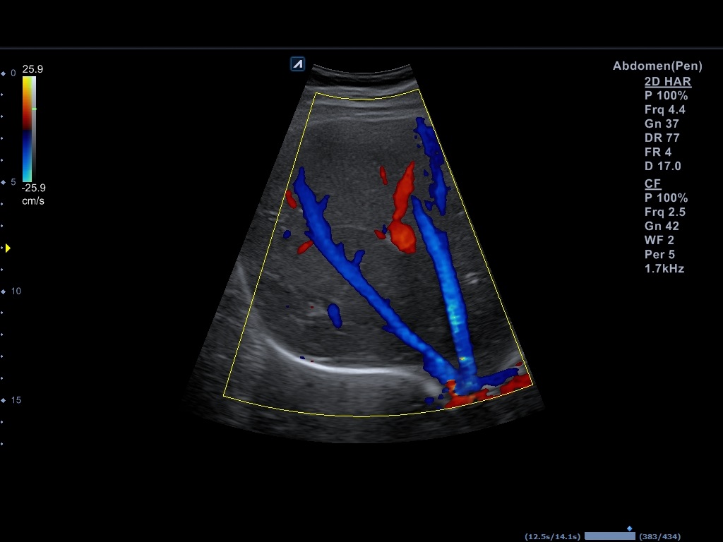 اجهزة سونار و ايكو Ultrasound & Echo جهاز سونار Alpinion E-CUBE 8 LE