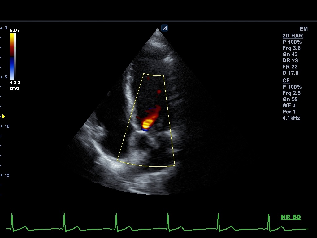 اجهزة سونار و ايكو Ultrasound & Echo جهاز سونار Alpinion E-CUBE 8 LE