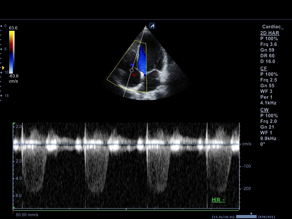 اجهزة سونار و ايكو Ultrasound & Echo جهاز سونار Alpinion E-CUBE 8 LE