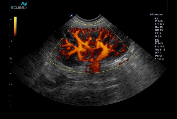 اجهزة سونار و ايكو Ultrasound & Echo جهاز سونار Alpinion E-CUBE I7