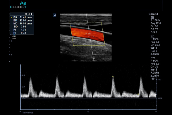 اجهزة سونار و ايكو Ultrasound & Echo جهاز سونار Alpinion E-CUBE I7