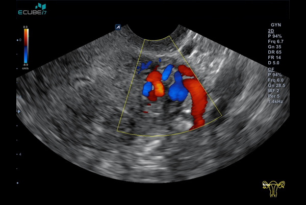 اجهزة سونار و ايكو Ultrasound & Echo جهاز سونار Alpinion E-CUBE I7