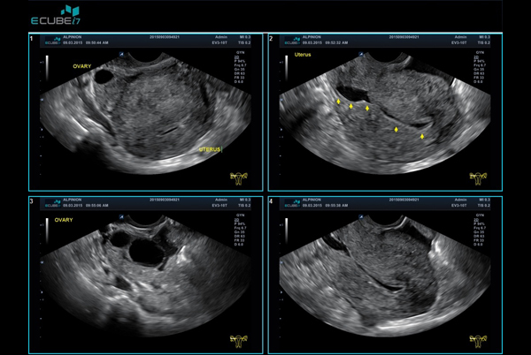 اجهزة سونار و ايكو Ultrasound & Echo جهاز سونار Alpinion E-CUBE I7